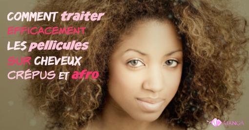 Comment traiter efficacement les pellicules sur cheveux crépus et afro
